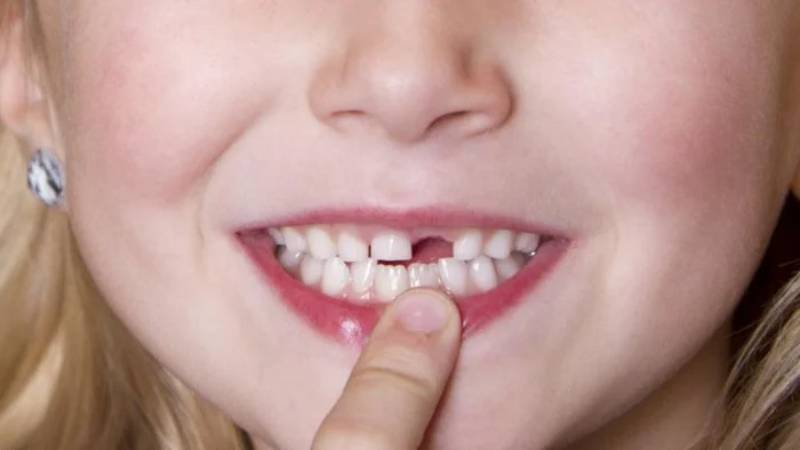 Điềm báo về giấc chiêm bao thấy rụng răng 